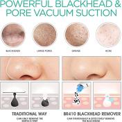 Blackhead Remover Vacuum Suction Facial Pore Cleaner