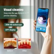 Electric Visual Tooth Cleaner - Plaque Remover