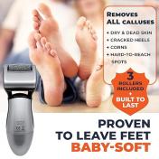 Rechargeable Callus Remover for Feet
