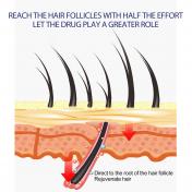 Extra Strength Hair Loss & Hair Growth Scalp Foam For Men