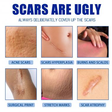 Repair And Fade Body Scars Gel Skin Care Cream